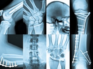 tac radiologia osteopata milano giorgio germano